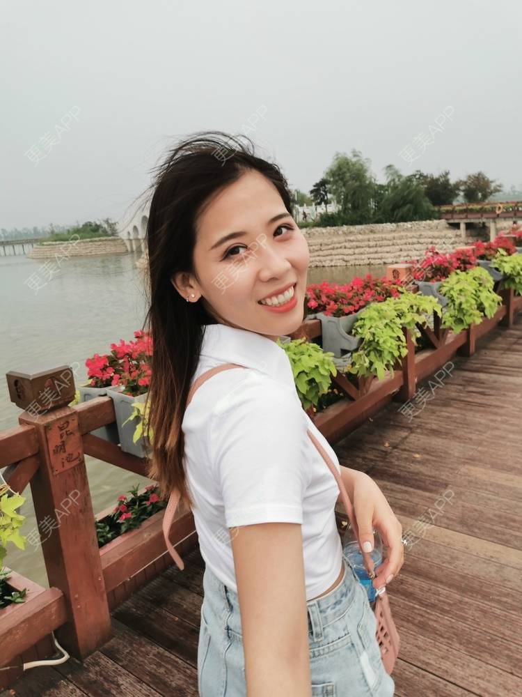 更美 - 更美用户YXs5bAlKu4的全切双眼皮经验 | 全切双眼皮 | 开内眼角 | 本溪 | 眼部多项