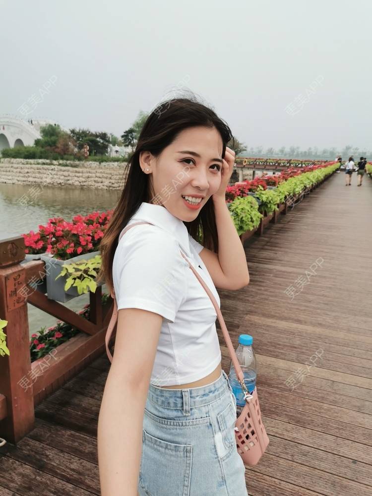 更美 - 更美用户YXs5bAlKu4的全切双眼皮经验 | 全切双眼皮 | 开内眼角 | 本溪 | 眼部多项