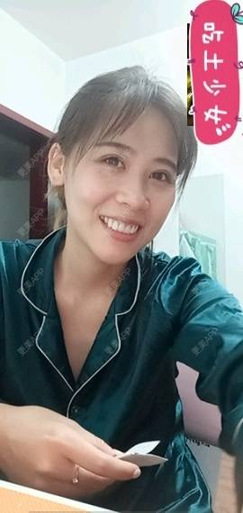 更美 - 更美用户YXs5bAlKu4的全切双眼皮经验 | 全切双眼皮 | 开内眼角 | 本溪 | 眼部多项