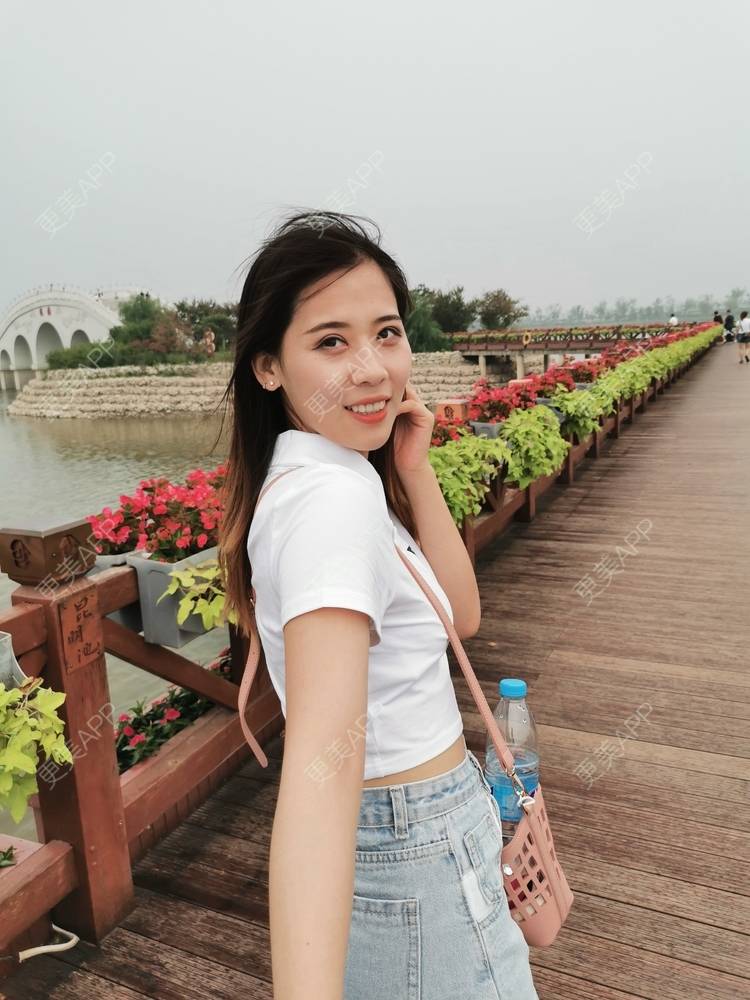 更美 - 更美用户YXs5bAlKu4的全切双眼皮经验 | 全切双眼皮 | 开内眼角 | 本溪 | 眼部多项