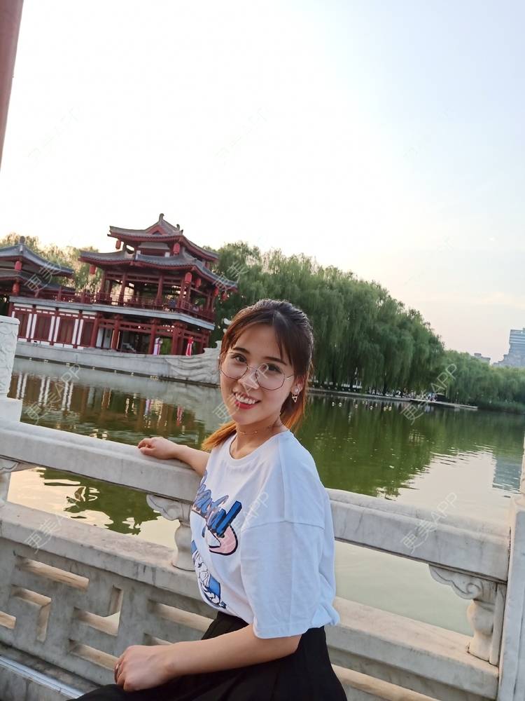 更美 - 更美用户YXs5bAlKu4的全切双眼皮经验 | 全切双眼皮 | 开内眼角 | 本溪 | 眼部多项