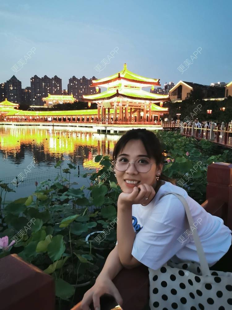 更美 - 更美用户YXs5bAlKu4的全切双眼皮经验 | 全切双眼皮 | 开内眼角 | 本溪 | 眼部多项