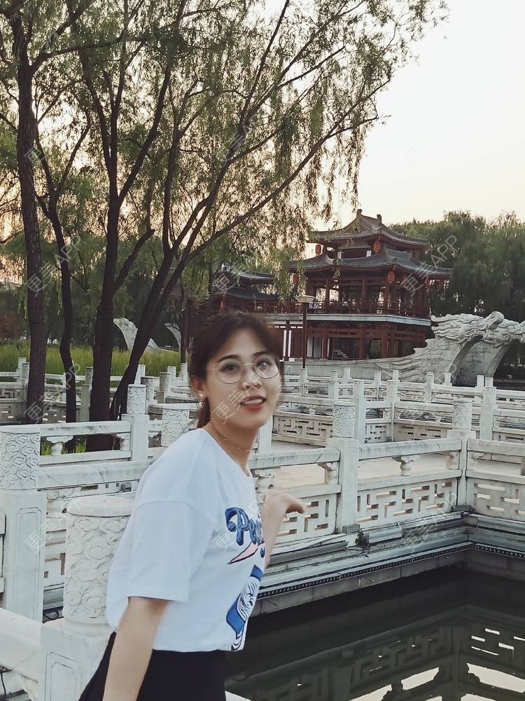 更美 - 更美用户YXs5bAlKu4的全切双眼皮经验 | 全切双眼皮 | 开内眼角 | 本溪 | 眼部多项