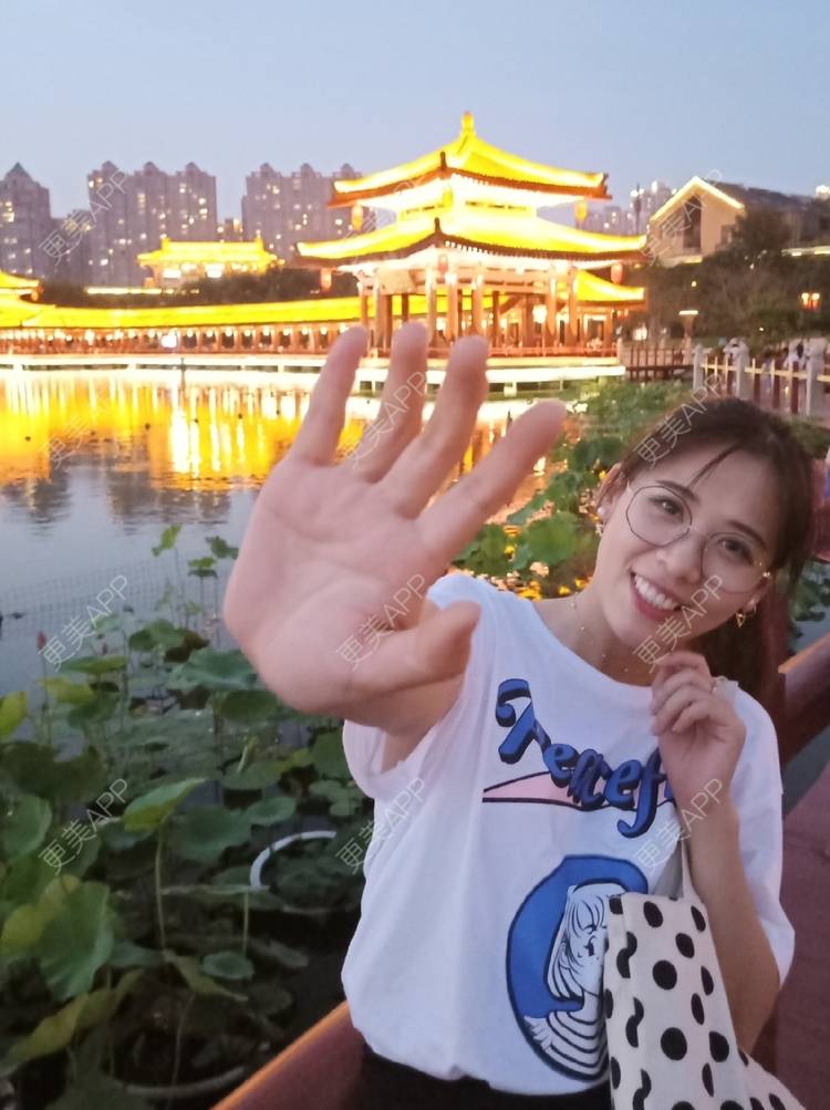 更美 - 更美用户YXs5bAlKu4的全切双眼皮经验 | 全切双眼皮 | 开内眼角 | 本溪 | 眼部多项