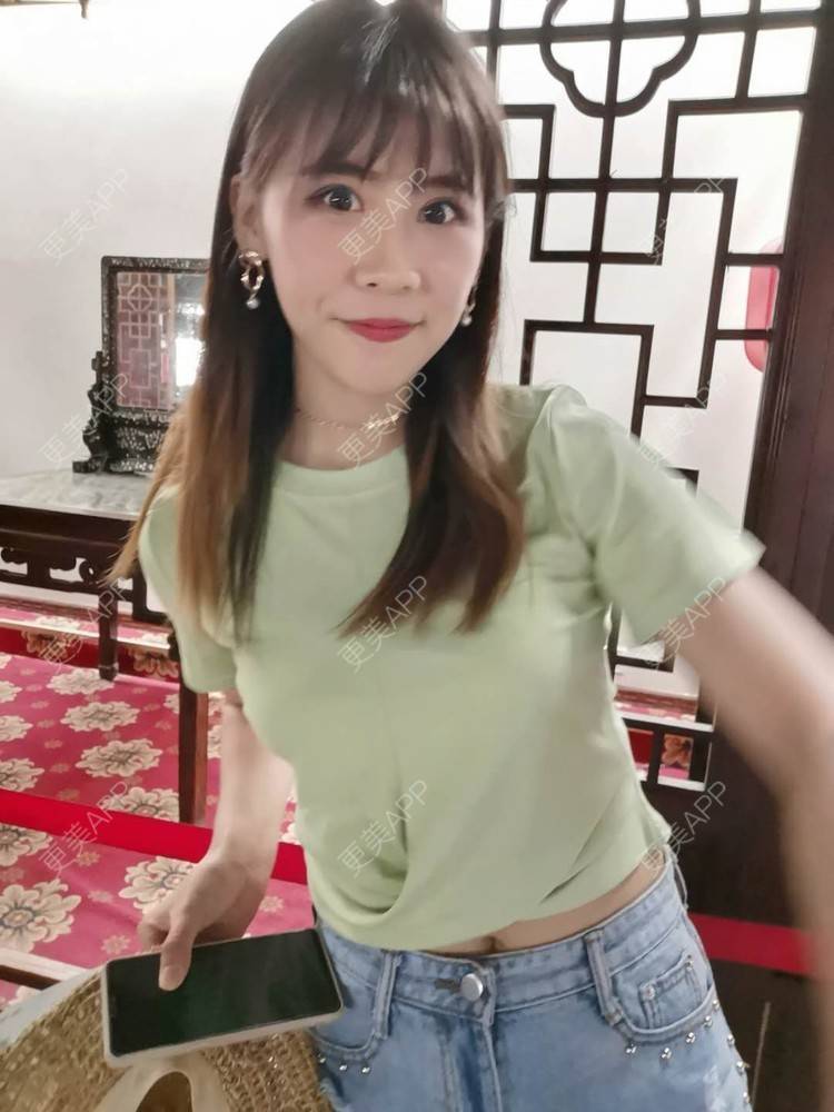 更美 - 更美用户YXs5bAlKu4的全切双眼皮经验 | 全切双眼皮 | 开内眼角 | 本溪 | 眼部多项