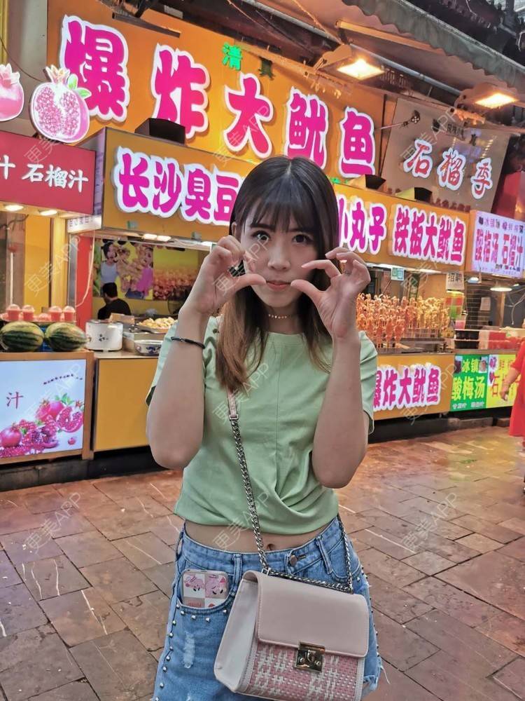 更美 - 更美用户YXs5bAlKu4的全切双眼皮经验 | 全切双眼皮 | 开内眼角 | 本溪 | 眼部多项