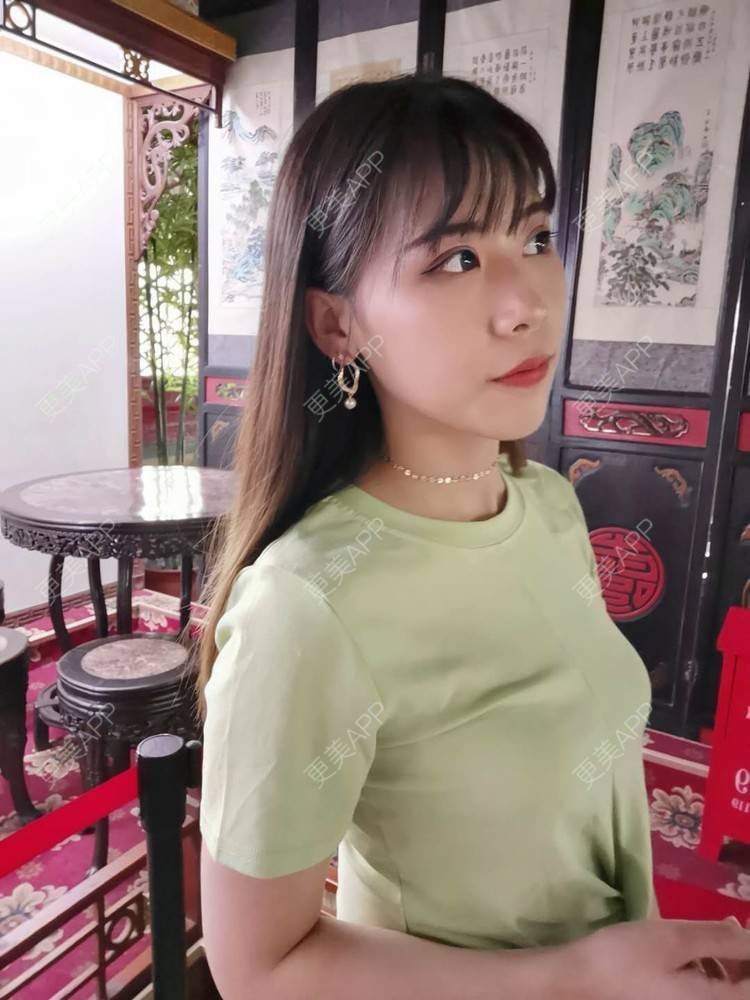 更美 - 更美用户YXs5bAlKu4的全切双眼皮经验 | 全切双眼皮 | 开内眼角 | 本溪 | 眼部多项