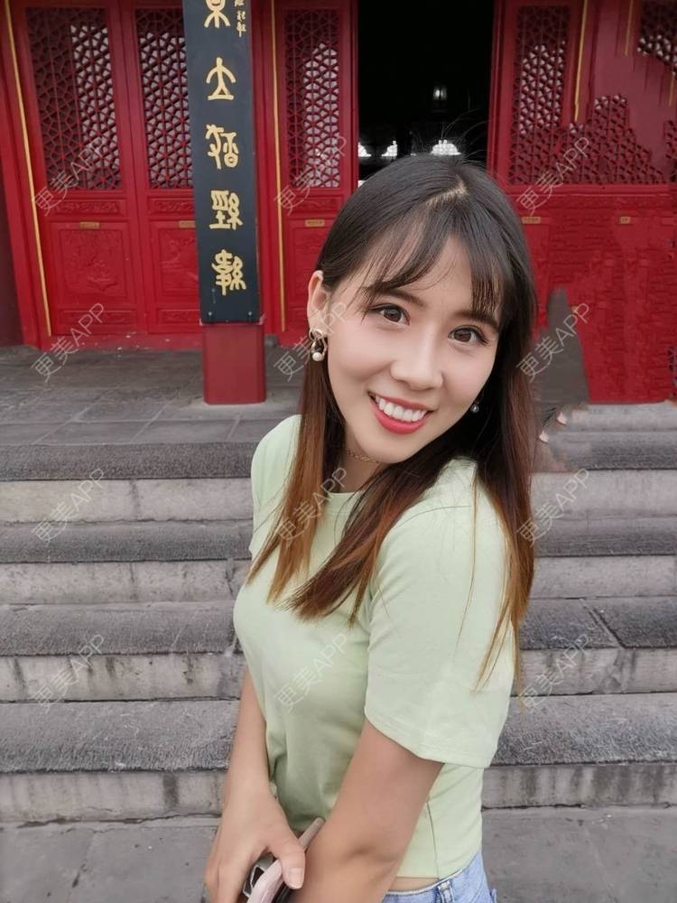 更美 - 更美用户YXs5bAlKu4的全切双眼皮经验 | 全切双眼皮 | 开内眼角 | 本溪 | 眼部多项