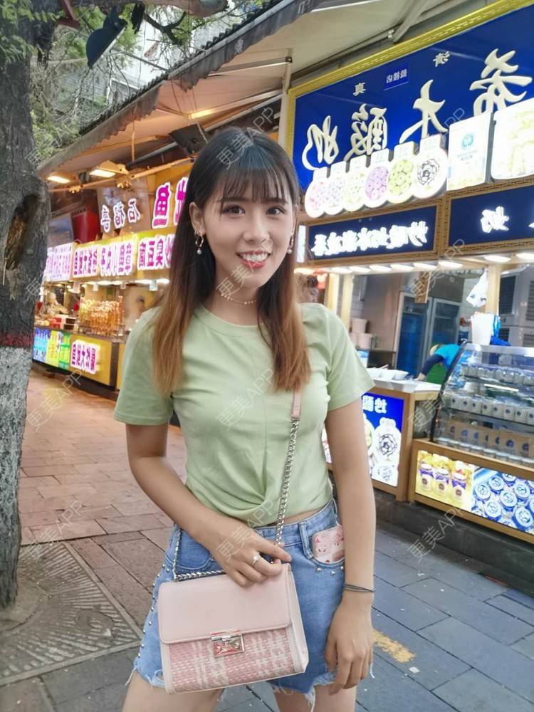 更美 - 更美用户YXs5bAlKu4的全切双眼皮经验 | 全切双眼皮 | 开内眼角 | 本溪 | 眼部多项