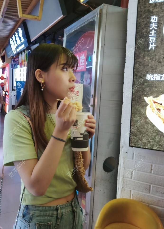 更美 - 更美用户YXs5bAlKu4的全切双眼皮经验 | 全切双眼皮 | 开内眼角 | 眼部多项