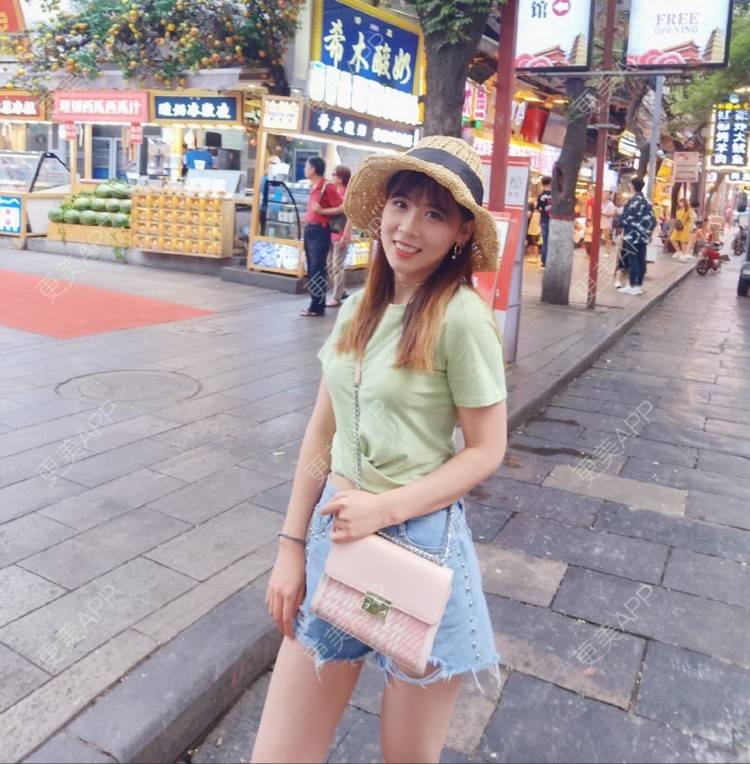 更美 - 更美用户YXs5bAlKu4的全切双眼皮经验 | 全切双眼皮 | 开内眼角 | 眼部多项