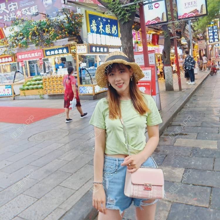 更美 - 更美用户YXs5bAlKu4的全切双眼皮经验 | 全切双眼皮 | 开内眼角 | 眼部多项