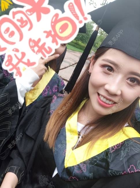 更美 - 更美用户YXs5bAlKu4的全切双眼皮经验 | 全切双眼皮 | 开内眼角 | 本溪 | 眼部多项