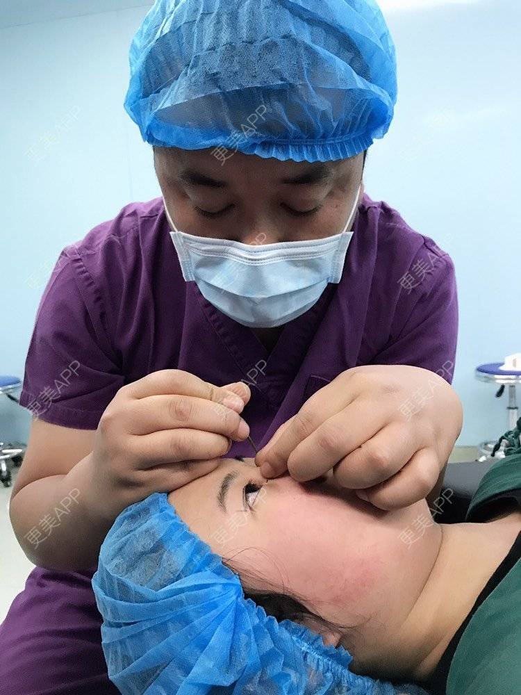 更美 - 云南华美美莱美容医院的双眼皮经验 | 双眼皮 | 昆明 | 眼部多项
