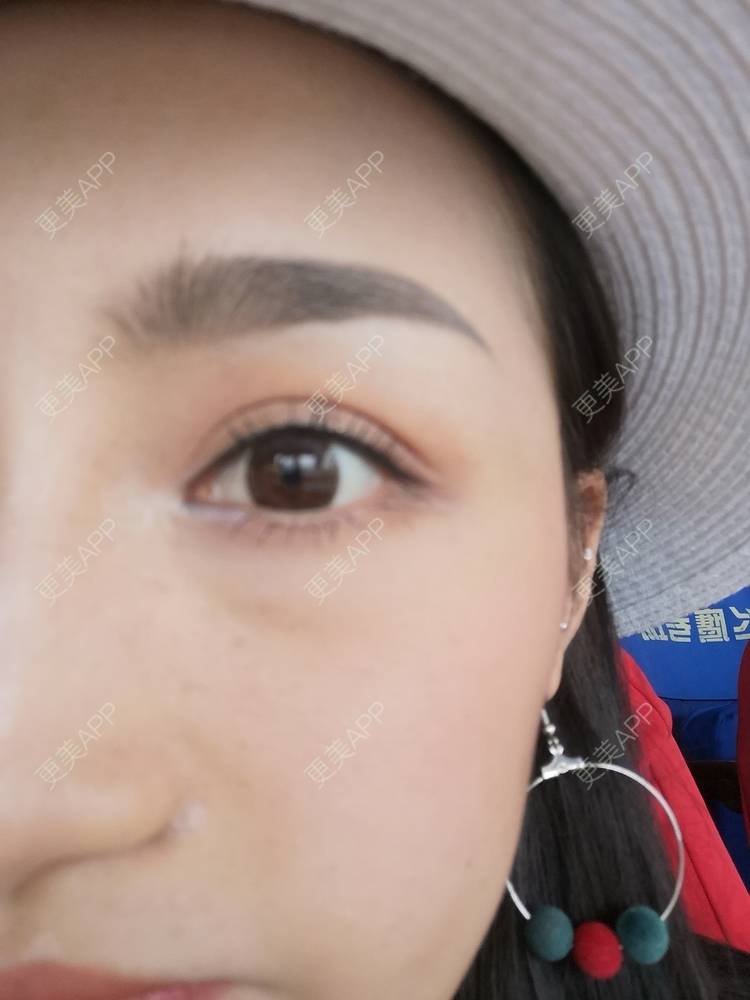 更美 - 淑芳宅_斋的除皱瘦脸经验 | 视频日记 | 除皱瘦脸 | 长沙