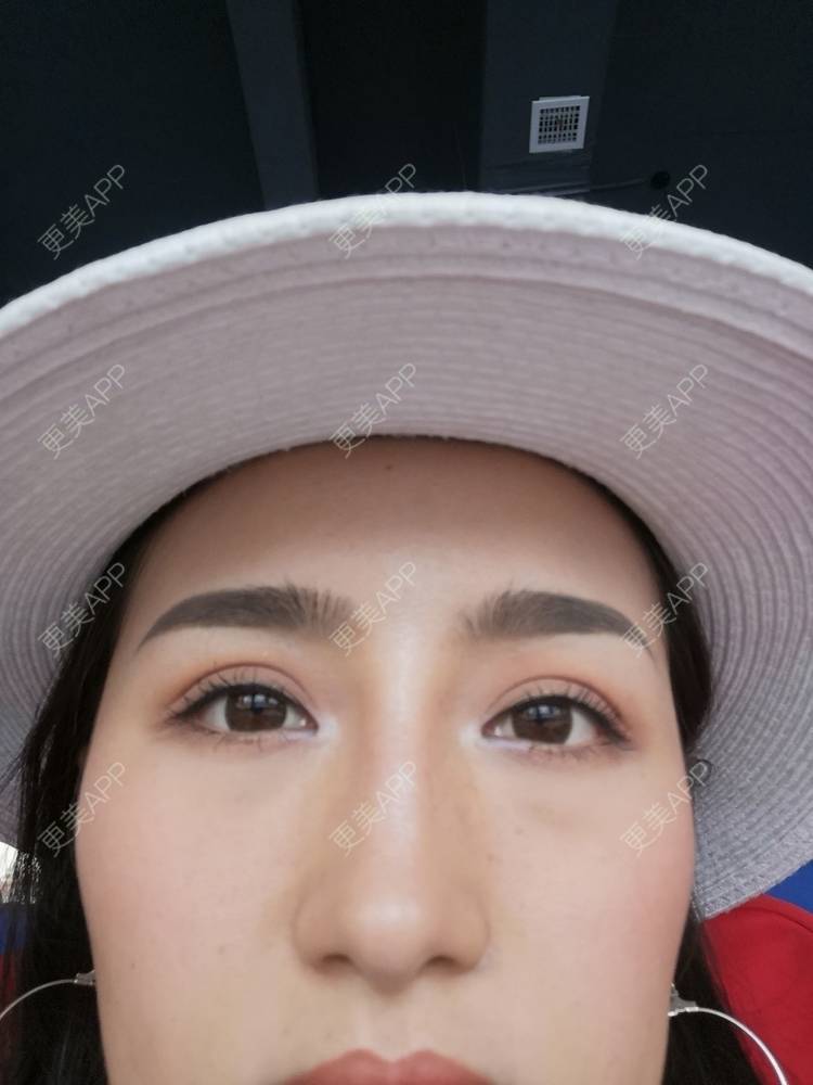 更美 - 淑芳宅_斋的除皱瘦脸经验 | 视频日记 | 除皱瘦脸 | 长沙