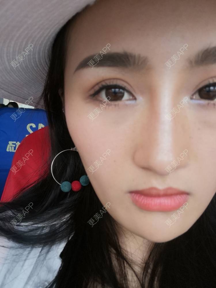 更美 - 淑芳宅_斋的除皱瘦脸经验 | 视频日记 | 除皱瘦脸 | 长沙