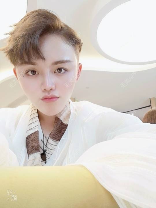 更美 - 更美用户rLJusWfgfC的面部脱毛经验 | 面部脱毛 | 武汉
