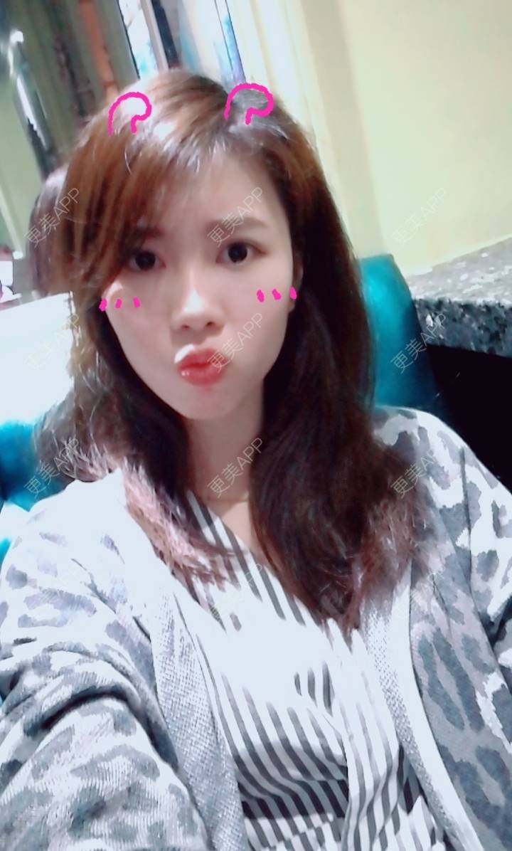 更美 - 西瓜西瓜圓又大🍉的隐形牙齿矫正经验 | 上海 | 隐形牙齿矫正