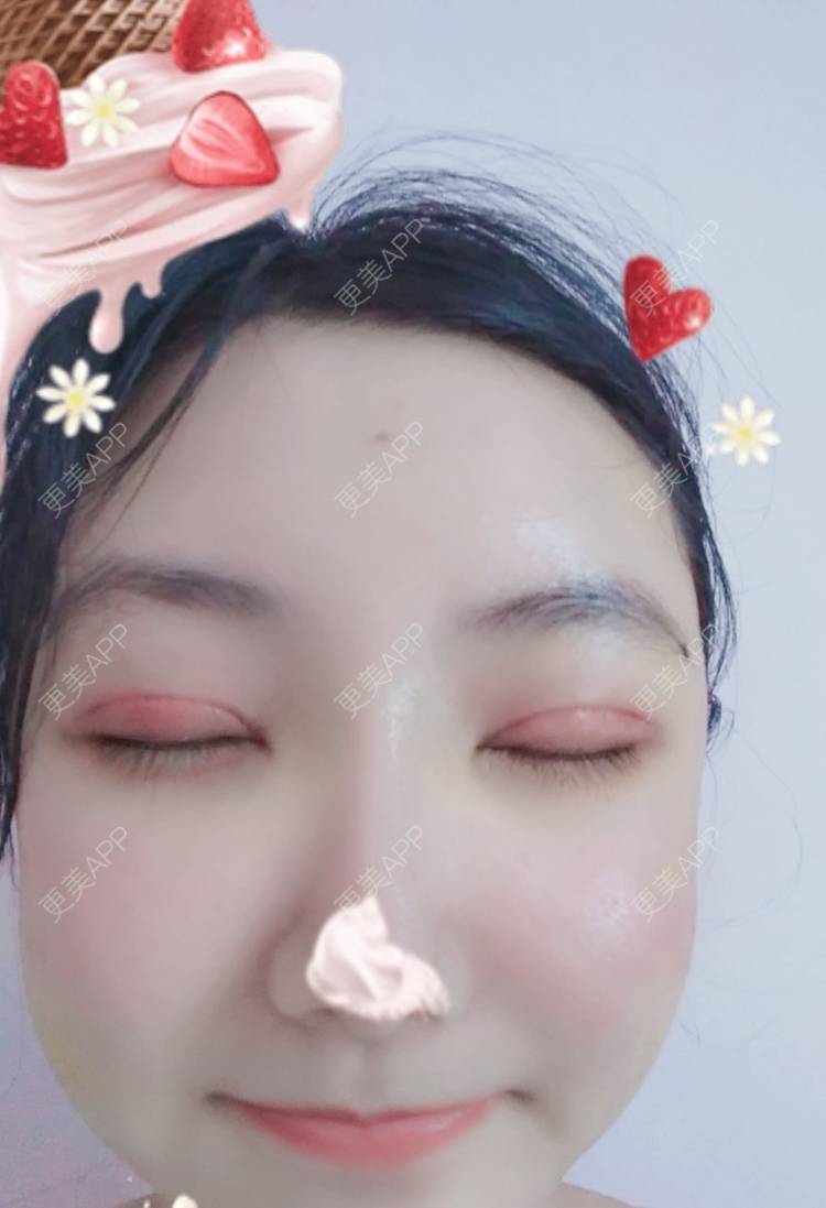 更美 - 更美用户EBRrEIgptp的颧骨颧弓经验 | 颧骨颧弓 | 郑州