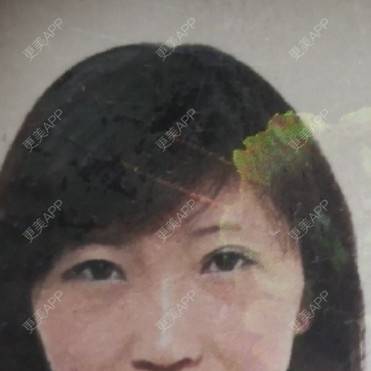 更美 - 更美用户82758634的激光去眼袋经验 | 激光去眼袋 | 上海