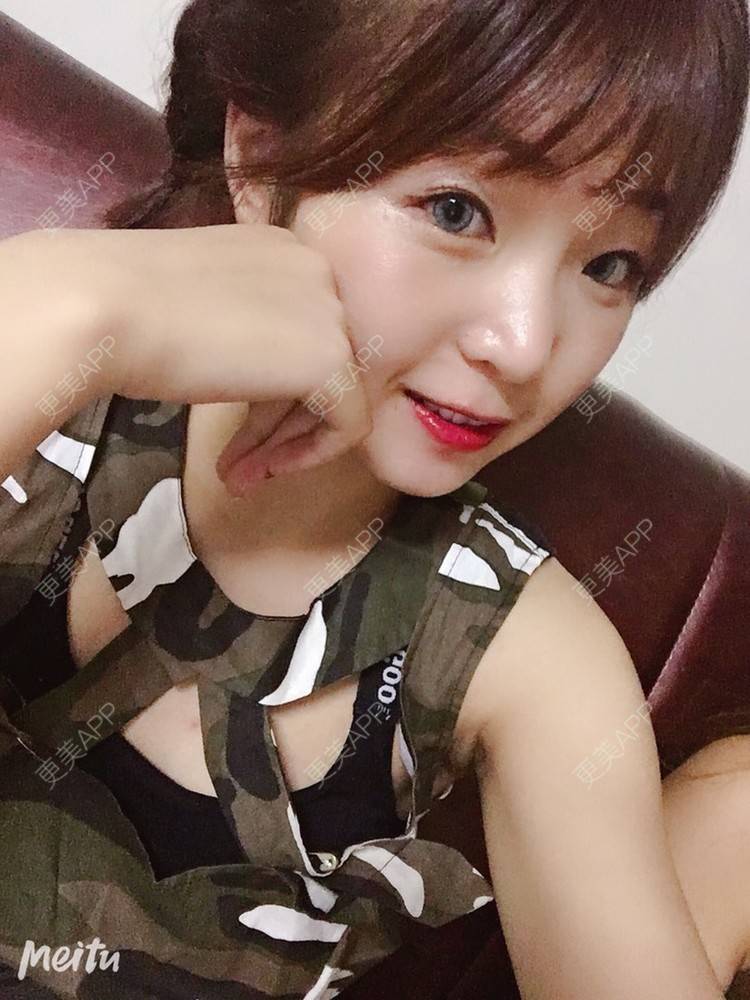 更美 - 更美用户6d6gGsAMox的双眼皮经验 | 双眼皮 | 石家庄