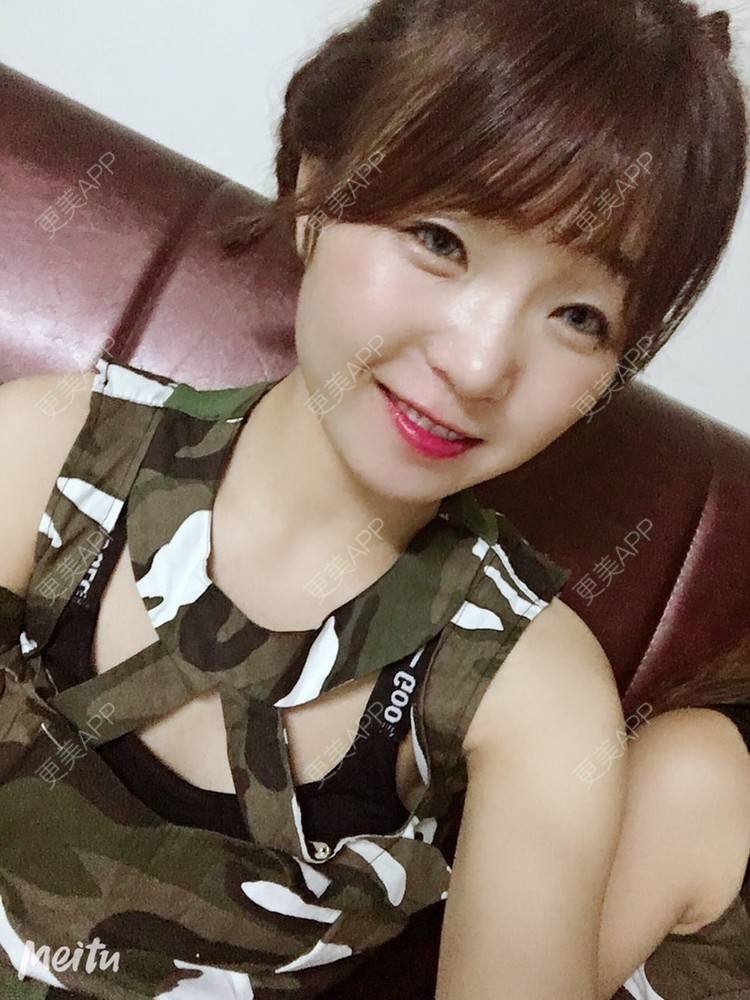 更美 - 更美用户6d6gGsAMox的双眼皮经验 | 双眼皮 | 石家庄