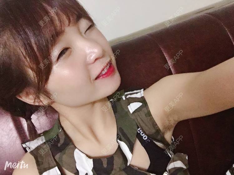 更美 - 更美用户6d6gGsAMox的双眼皮经验 | 双眼皮 | 石家庄