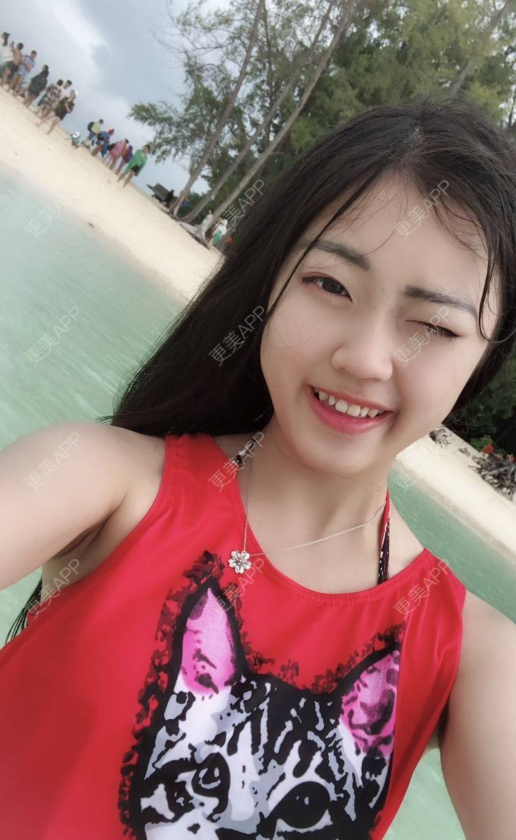 更美 - 小禅子的经验 | 成都 | 视频日记 | 激光淡疤 | 手术淡疤