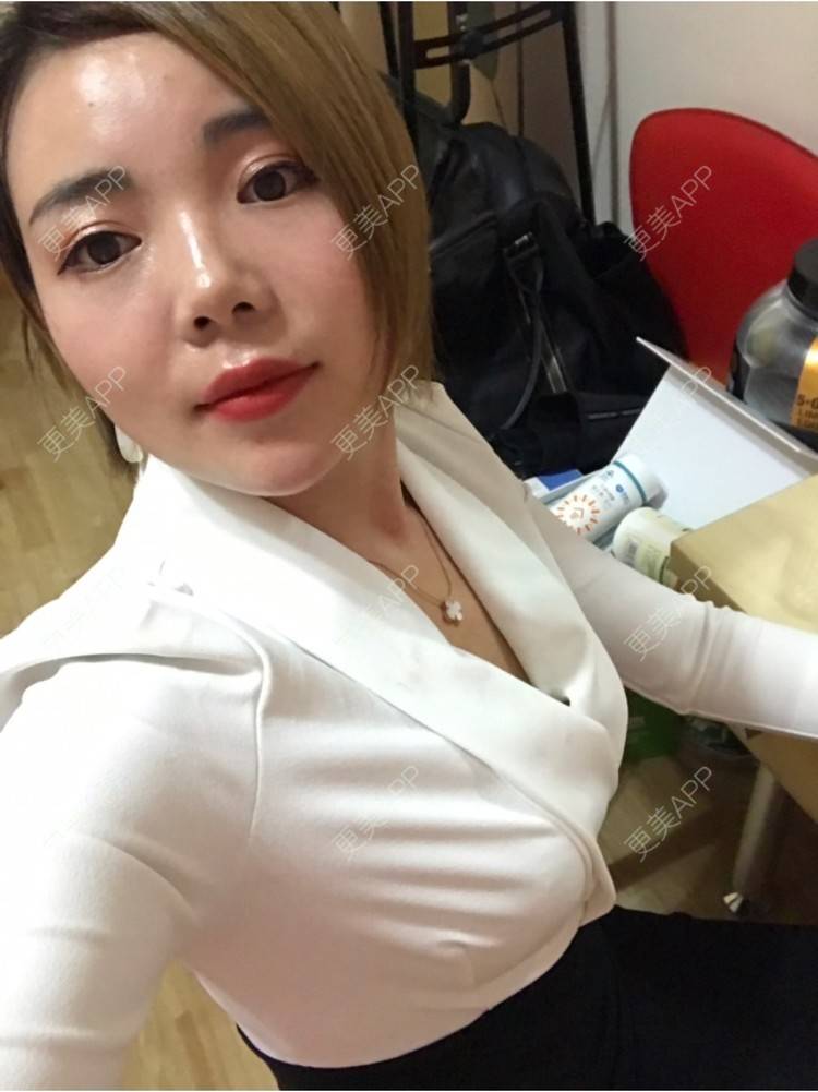 更美 - 更美用户PEQAv4UZm0的朝天鼻矫正经验 | 朝天鼻矫正 | 上海