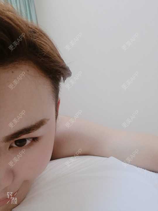 更美 - 更美用户rLJusWfgfC的面部脱毛经验 | 面部脱毛 | 武汉