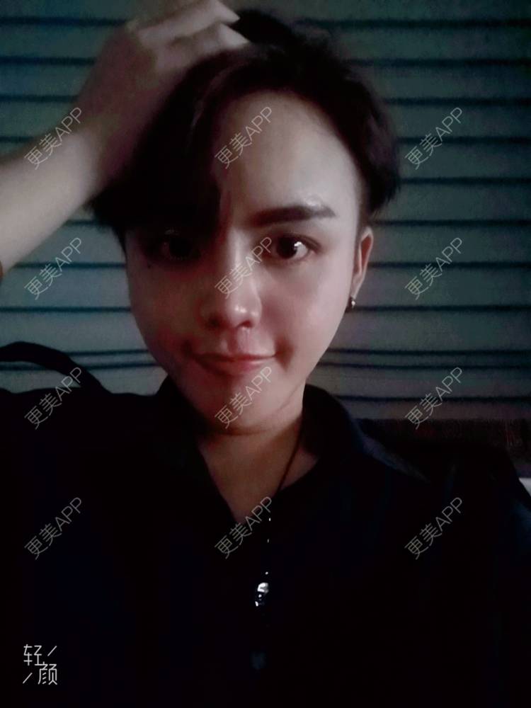 更美 - 更美用户rLJusWfgfC的面部脱毛经验 | 面部脱毛 | 武汉