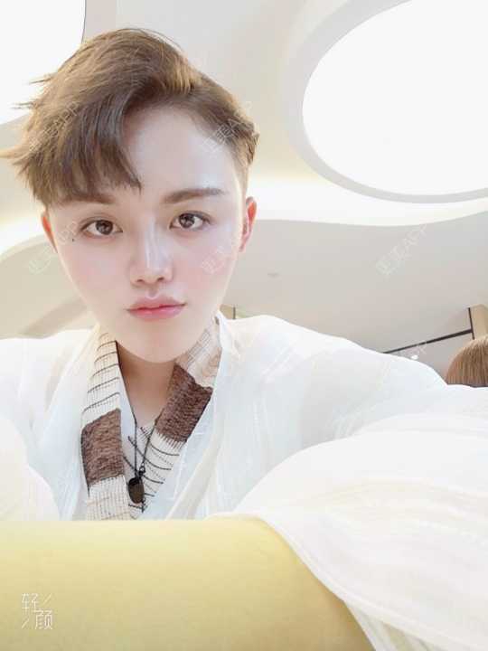 更美 - 更美用户rLJusWfgfC的面部脱毛经验 | 面部脱毛 | 武汉