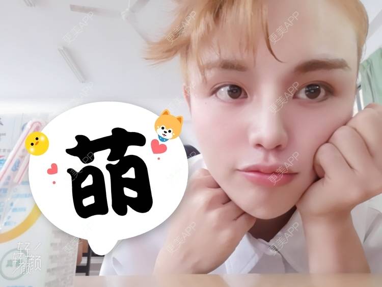 更美 - 更美用户吕祥的面部脱毛经验 | 面部脱毛 | 苏州 | 美购日记