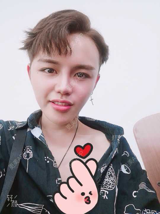 更美 - 更美用户吕祥的面部脱毛经验 | 面部脱毛 | 苏州 | 美购日记