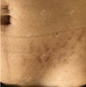 更美用户KpoO2wpZCv