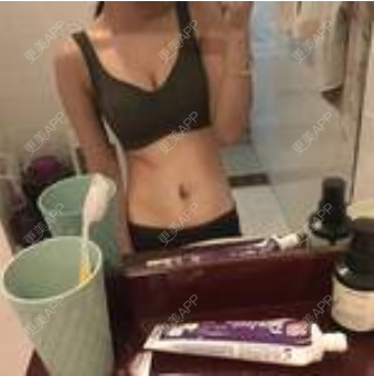 更美 - 更美用户KpoO2wpZCv的微针淡化妊娠纹经验 | 上海 | 微针淡化妊娠纹