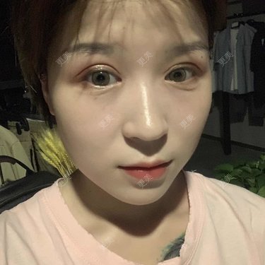 徐金玉 医生