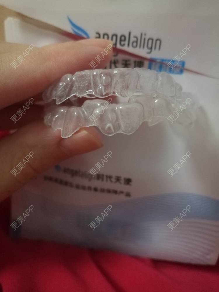 更美 - 西瓜西瓜圓又大🍉的隐形牙齿矫正经验 | 隐形牙齿矫正 | 上海