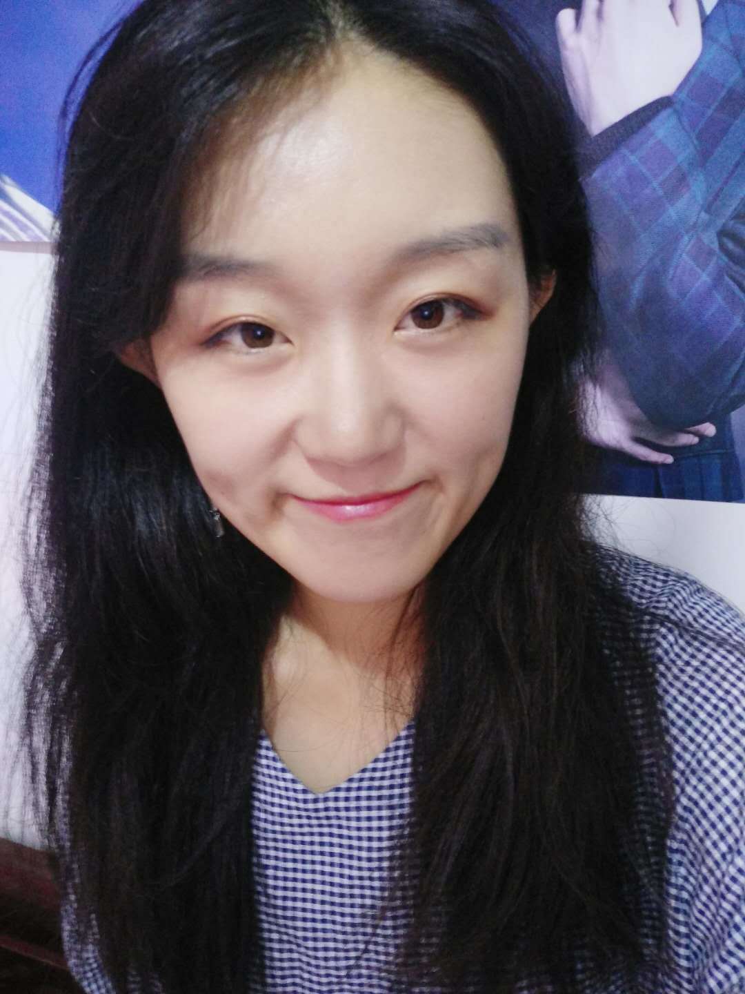 北京安贞医院整形外科杨媚怎么样?自体脂肪填充案例和价格同步分享！