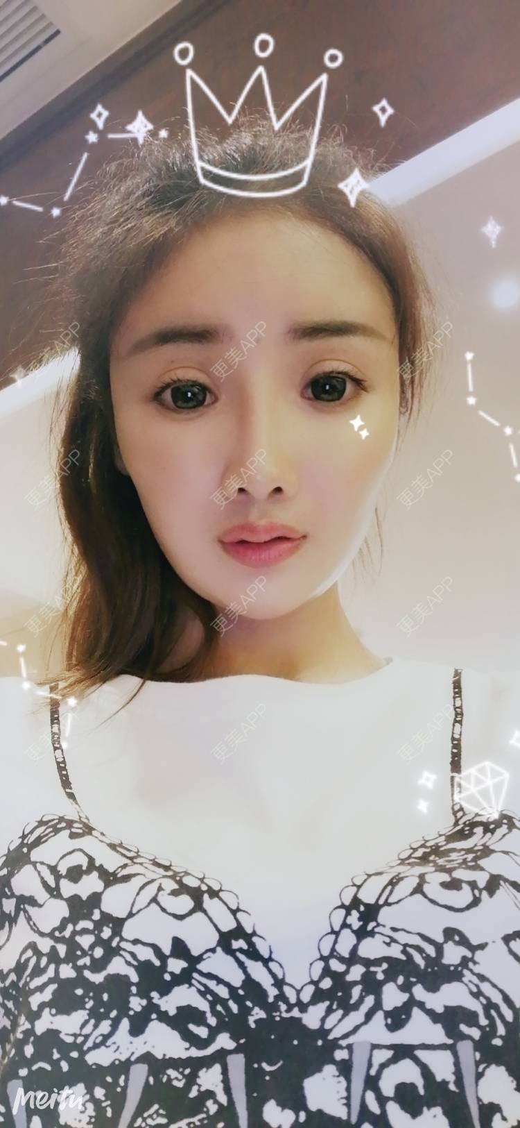 更美 - 酢乙女爱+花轮的玻尿酸经验 | 南京 | 玻尿酸 | 玻尿酸套餐