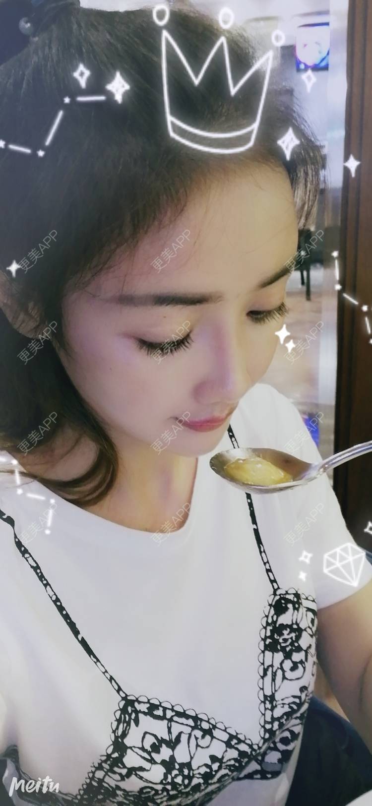 更美 - 酢乙女爱+花轮的玻尿酸经验 | 南京 | 玻尿酸 | 玻尿酸套餐