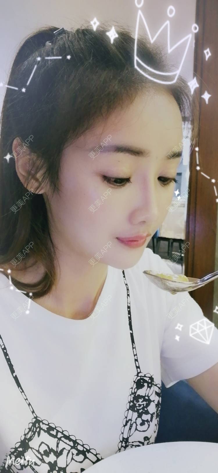 更美 - 酢乙女爱+花轮的玻尿酸经验 | 南京 | 玻尿酸 | 玻尿酸套餐