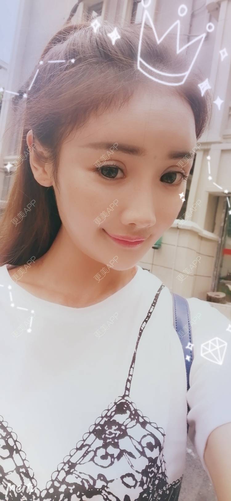 更美 - 酢乙女爱+花轮的玻尿酸经验 | 南京 | 玻尿酸 | 玻尿酸套餐