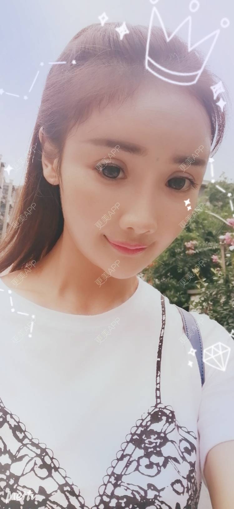 更美 - 酢乙女爱+花轮的玻尿酸经验 | 南京 | 玻尿酸 | 玻尿酸套餐