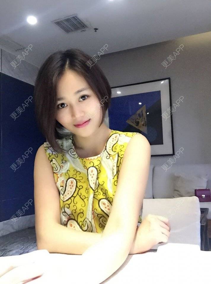 更美 - 顽固不化的假体垫苹果肌经验 | 北京 | 假体垫苹果肌