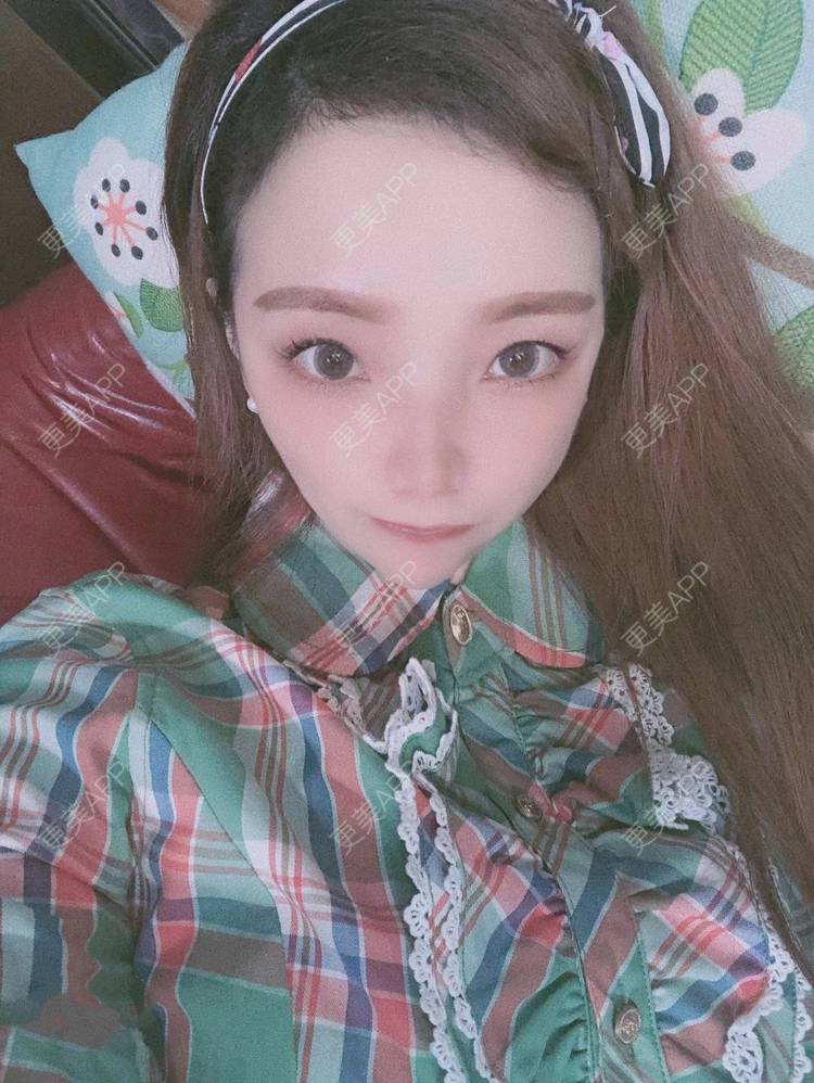 更美 - 更美用户EWqDuvHmIb的自体脂肪丰面颊经验 | 自体脂肪丰面颊 | 成都
