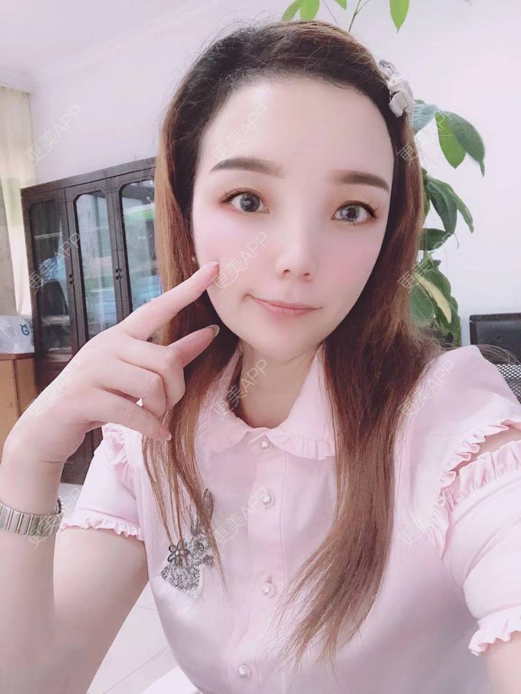 更美 - 更美用户EWqDuvHmIb的自体脂肪丰面颊经验 | 自体脂肪丰面颊 | 成都