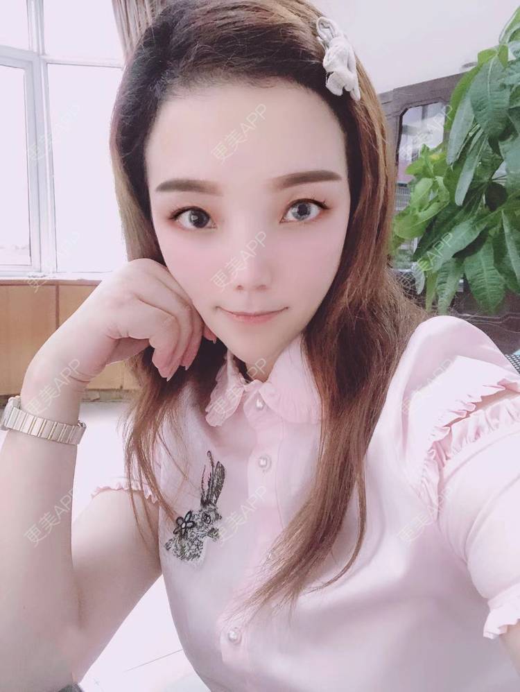 更美 - 更美用户EWqDuvHmIb的自体脂肪丰面颊经验 | 自体脂肪丰面颊 | 成都