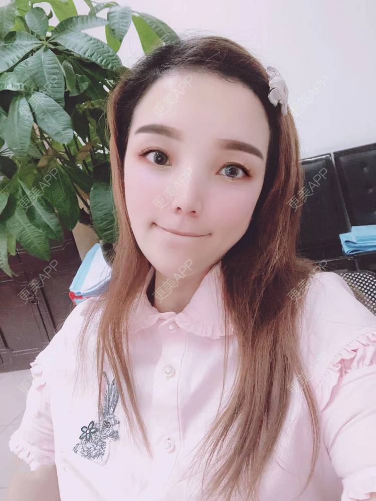 更美 - 更美用户EWqDuvHmIb的自体脂肪丰面颊经验 | 自体脂肪丰面颊 | 成都